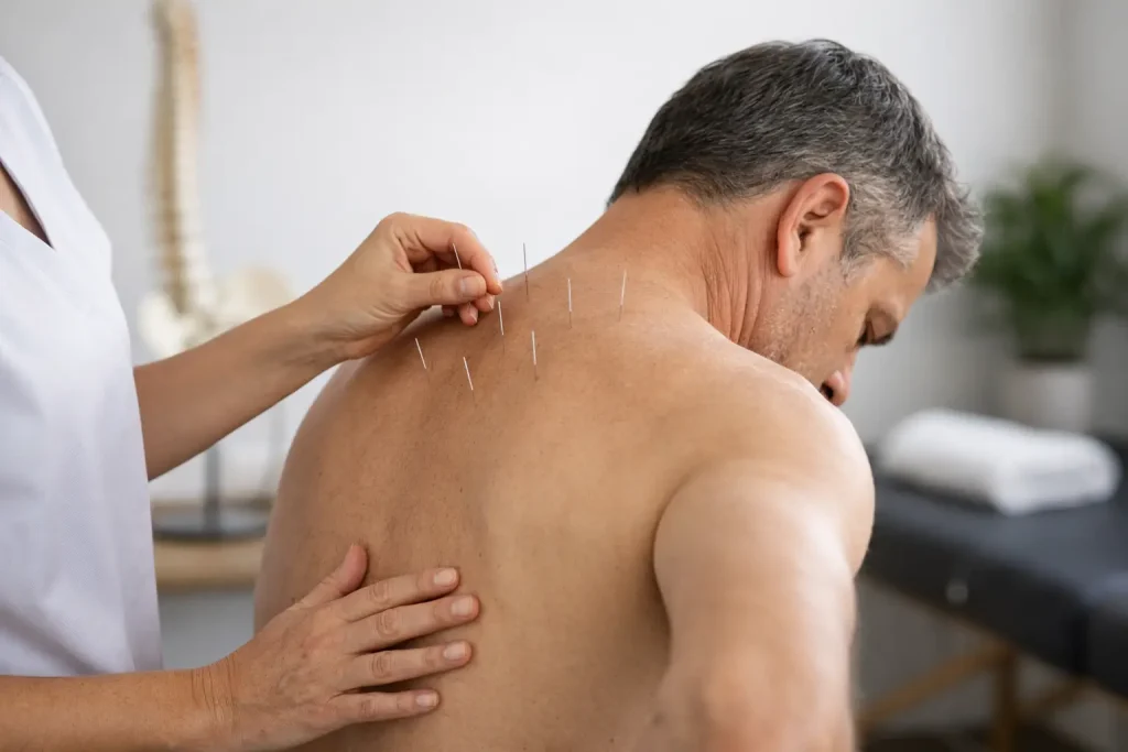 Does Acupuncture for Back Pain Work?